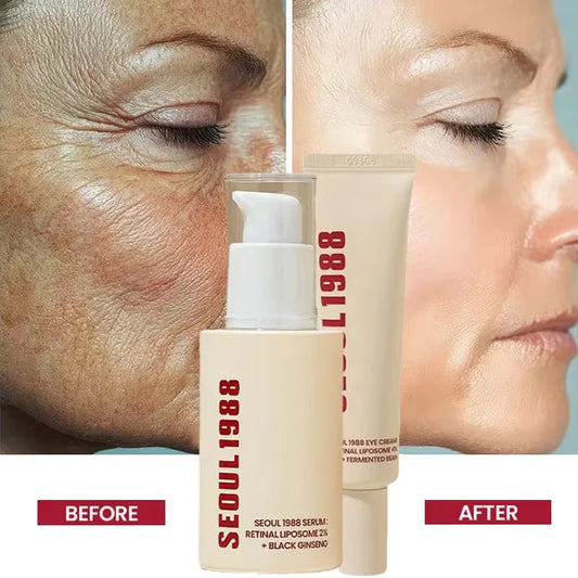 SEOUL 1988 Retinol Skincare Set – Black Ginseng Serum, Retinal Eye Cream & Hydrating Face Cream