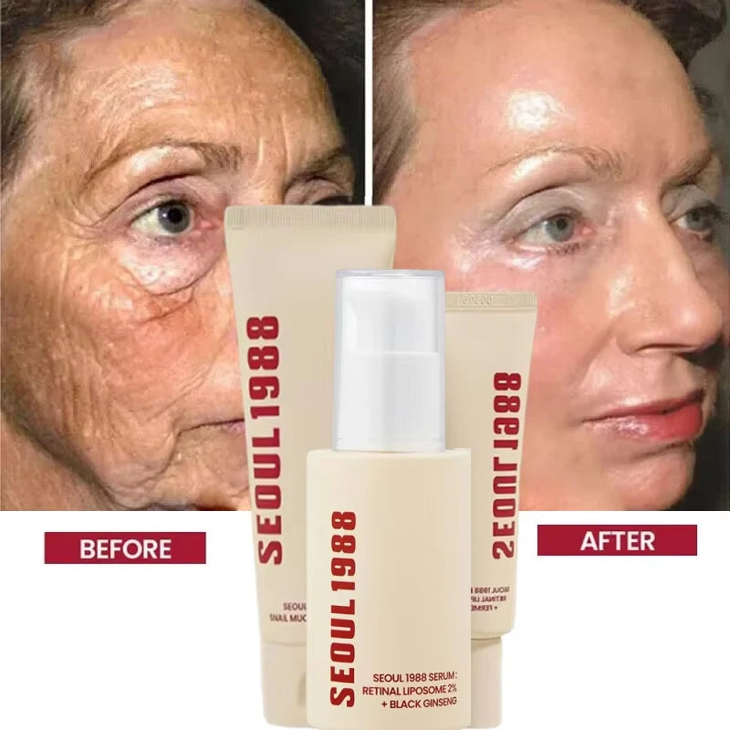 SEOUL 1988 Retinol Skincare Set – Black Ginseng Serum, Retinal Eye Cream & Hydrating Face Cream