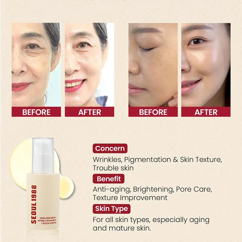 SEOUL 1988 Retinol Skincare Set – Black Ginseng Serum, Retinal Eye Cream & Hydrating Face Cream