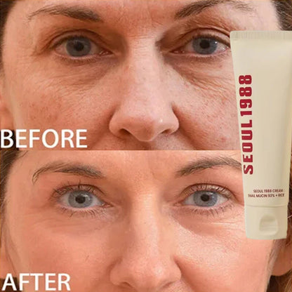 SEOUL 1988 Retinol Skincare Set – Black Ginseng Serum, Retinal Eye Cream & Hydrating Face Cream